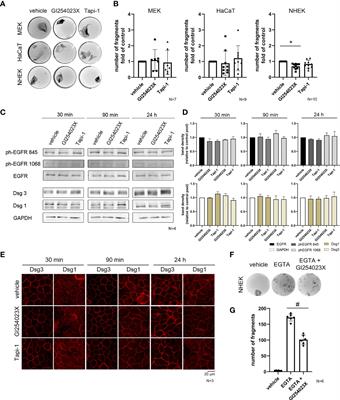 Role of ADAM10 and ADAM17 in the Regulation of Keratinocyte Adhesion in Pemphigus Vulgaris